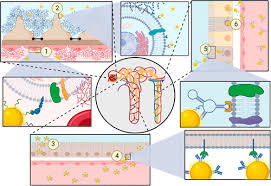 Spotlight On Genetic Kidney Diseases A