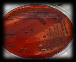 Its solubility is greater in organic solvents. Congo Red Agar With Positive Result Download Scientific Diagram