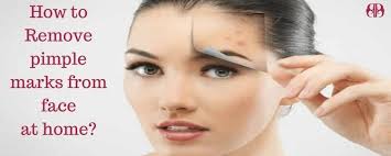 remove pimple marks from face remes