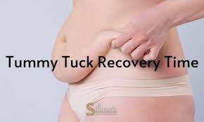 tummy tuck recovery time silhouette
