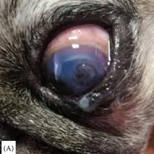 riboflavin uv a corneal phototherapy