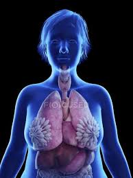 The female reproductive system is made up of the internal and external sex organs that function in reproduction of new offspring. Illustration On Black Of Silhouette Of Obese Woman With Highlighted Internal Organs Lungs Science Stock Photo 236811830