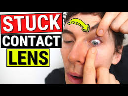 stuck contact lens from the eye