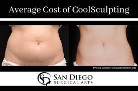 the average cost of coolsculpting san