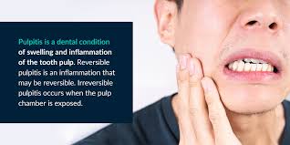 what causes an infected tooth pulp
