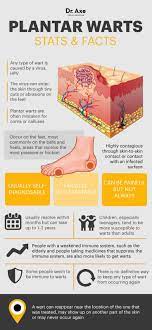 stop plantar warts in their tracks with