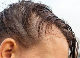 stop hair fall after keratin treatment