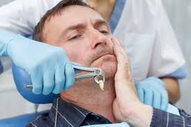 recovery process for tooth extraction