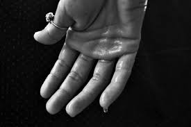 Image result for people with excessive sweaty hands Kenya