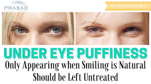 puffiness under eyes that only appears