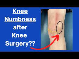 knee numbness after knee surgery