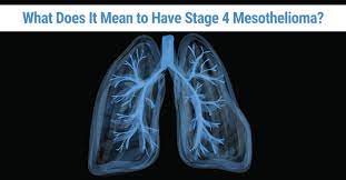 A patient's outlook depends mainly on the extent of the tumor growth in addition to how well their body responds to treatments. Stage 4 Mesothelioma Life Expectancy Palliative Treatments