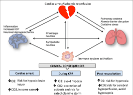 Cardiac arrest is an extreme and sudden medical emergency and condition where the heart stops. Systemic Effect Of Cardiac Arrest And Clinical Implications In The Download Scientific Diagram