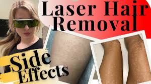 side effects laser hair removal tips