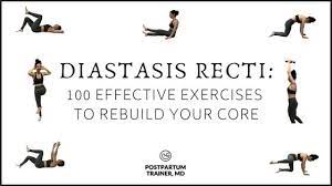 100 effective diastasis recti exercises