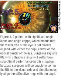 reviewofophthalmology com cmsimagescontent 202