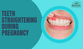 teeth straightening during pregnancy