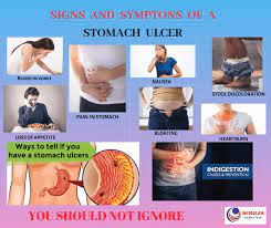 peptic ulcer a painful ulceration in
