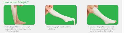 Tubigrip Elasticated Tubular Bandage Molnlycke Healthcare