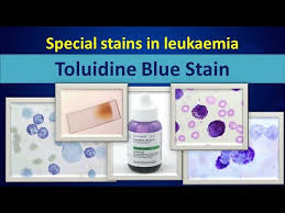 toluidine blue special stain in