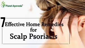 home remes for scalp psoriasis