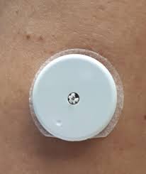 This sensor takes only a second to scan and can even scan. The Dexcom Glucose Monitoring System An Isobornyl Acrylate Free Alternative For Diabetic Patients Oppel 2019 Contact Dermatitis Wiley Online Library