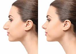 how to make your nose smaller sedgh