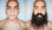 how-can-i-force-facial-hair-growth