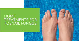 home treatments for toenail fungus