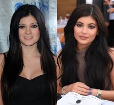 This caused plenty of speculation as to whether she got a breast enhancement or if it was just a sign of growing up. Fans Shocked By Changing Face Of Kylie Jenner Nz Herald