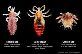 crab body and head lice pests