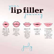 lip services juvly aesthetics