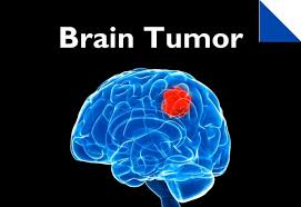 Brain Tumor Treatment Johns Hopkins Medicine