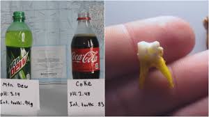 mountain dew and coca cola rot teeth