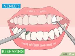 Guides depicting harmful, dangerous, or destructive content will be removed. 3 Ways To Fix An Underbite Wikihow