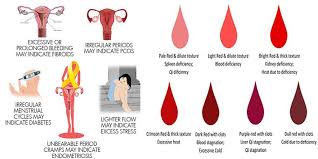 Period Blood Color Period With Clots Heavy Period With