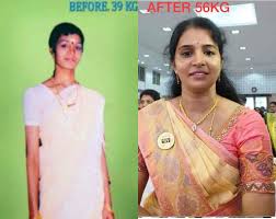 top weight loss consultants in t nagar