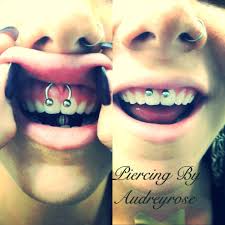 Want to know how a pierced smiley looks like. Smiley Piercing By Audreyrose Email Mrzkidghost1014 Yahoo Com Smiley Piercing Body Piercings Piercings
