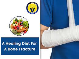 healing t for broken bones dr