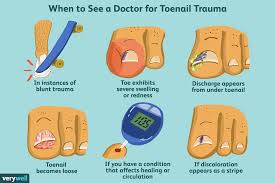 toenail hurts when pressed causes and