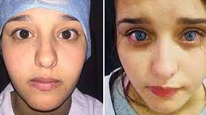 first eye color surgery occurs in morocco