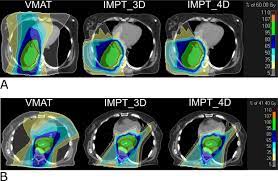 intensity modulated proton therapy