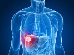 liver lesions types causes diagnosis