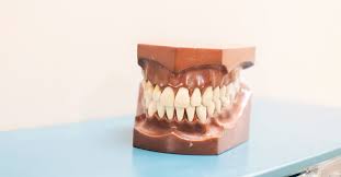 dental bridge vs implant what s the