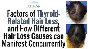 why thyroid hair loss should be