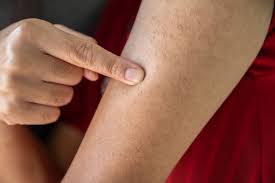 ps on skin symptoms causes and