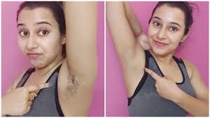 underarms hair removal