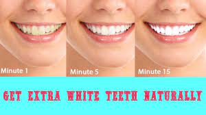 Essential home remedies for whitening the teeth with braces Make Your Teeth Crystal White Teeth With These 3 Natural Ways Sudbury Dental