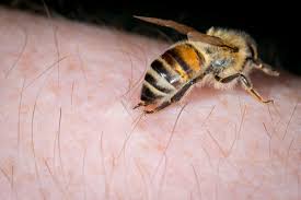 How Do Wasp And Bee Stings Work