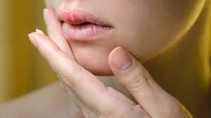 lips infection treatment in hindi